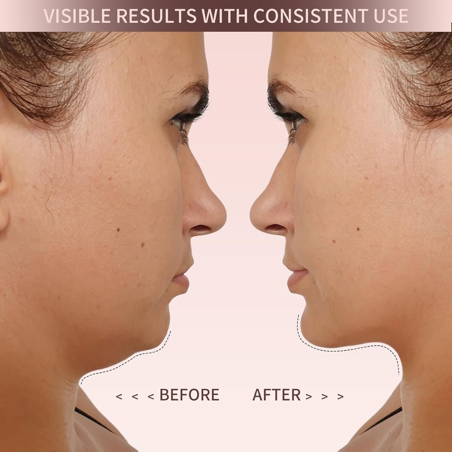 The Elevé Face Shaper