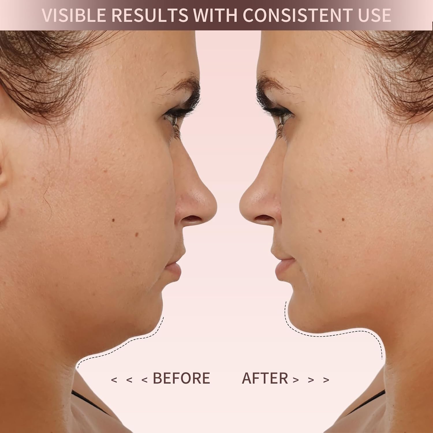 The Elevé Face Shaper