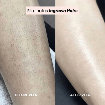 Rasoir VELA® 2 en 1