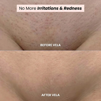 Rasoir VELA® 2 en 1