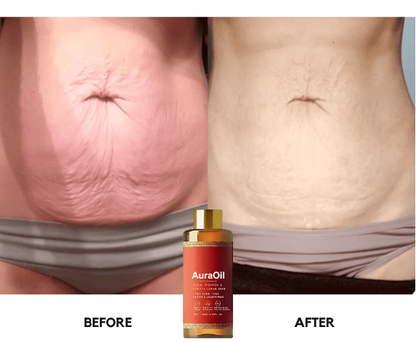 AuraOil – Le secret naturel d'une peau visiblement plus ferme, lisse et éclatante.