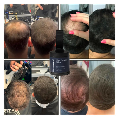 V-Density :Hair Filler Powder