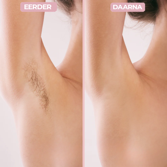 Vela Silk – Le secret d’une peau infiniment douce et d'un rasage zéro défaut.