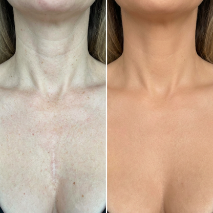 Lucky Skin™ -Le secret d'un bronzage doré sans trace et sans expositions aux UV.