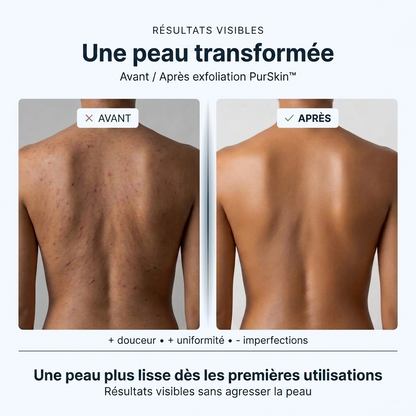 PurSkin™ – Le secret d'une peau douce, nette et sans imperfections