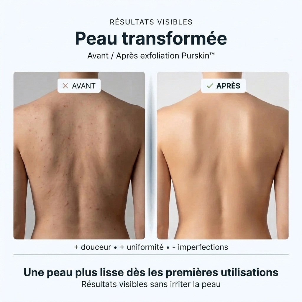 PurSkin™ – Le secret d'une peau douce, nette et sans imperfections