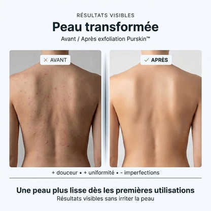 PurSkin™ – Le secret d'une peau douce, nette et sans imperfections