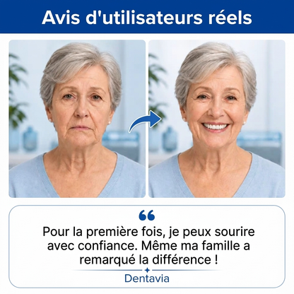 Prothèses dentaires sur mesure pour un confort quotidien